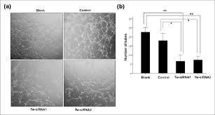 American cancer society stage 3 treatment. Twist1 Downregulation Inhibits Angiogenesis In Ovarian Cancer Cells Download Scientific Diagram