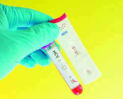 O a potential hcv exposure occurred within the past six months. Initial Hcv Test Results Are False Positive In Almost Half Of General Population Hcv Hub