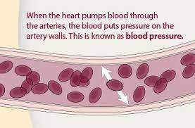 High Blood Pressure Symptoms And Causes Cdc Gov