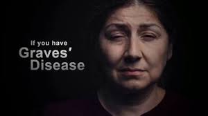 Horizon Therapeutics TV Spot, 'Graves' Disease: Dry and Sandy'