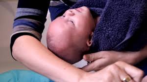 Baby hair loss is perfectly normal, and it often happens within the first six months. Infant Hair Loss Is Your Baby Going Bald Tips For Prevention