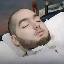 Saudi prince moves after 20 years in coma