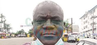 We Are Still Intensifying The Fight Against COVID-19”