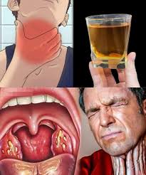 KILLS sore throat and inflammation. Natural antibiotic Must express  something to keep getting my recipes.... Thank you Recipe in (c.o.m.m.e.n.t  ).👇