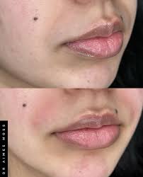 Dr Aimee Moss (@draimeemoss) • Instagram photos and videos