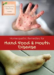 This is followed a day or two later by flat discolored spots or bumps that may blister, on the hands. Homeopathy For Hand Foot And Mouth Disease Ultimate Homeschool Podcast Network