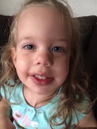 10 Things I Learned About Tongue and Lip Tie