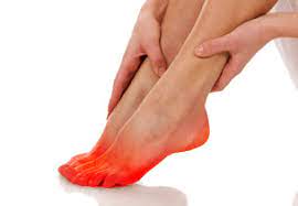 Burning feet-Causes-Diagnosis-Treatment-Homeopathic Treatment-Dr Qaisar Ahmed-Risalpur-KPK-Pakistan