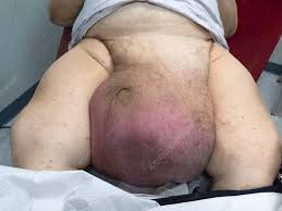 Image result for Scrotum