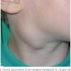 It is common for children to think that something they did caused a parent's cancer. 1
