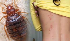Bed bug removal, cockroach exterminator Bed Bug Bites How To Avoid Them And Get Rid Of An Infestation Be Wary Of This Smell Express Co Uk
