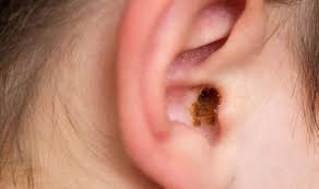 The waiters were all really friendly and polite, and they played traditional sitar music which was very relaxing. Ear Wax Removal How To Clean Your Ears Express Co Uk