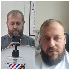 Cody Garbrandt opens up