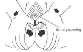 Perineal Care Bsuh Maternity