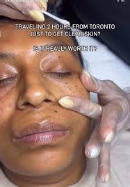 Allure Medical Spa Fresno Ca