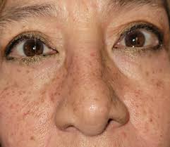 Experience with Dr. from Cali Colombia?