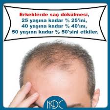 Hdc Protez Sac On Instagram Erkeklerde Daha Sik Olarak Gorulen Sac Dokulmesi 25 Yasina Kadar Erkeklerin 25 Ini 40 Yasina Kad 50 Yasinda Sac Dokulmesi Sac