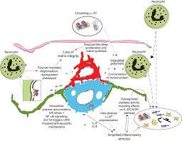 If these proteins are malformed or deficient, the impact is a predisposition for. Mechanisms Of Emphysema In A1 Antitrypsin Deficiency Molecular And Cellular Insights European Respiratory Society
