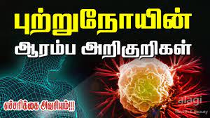 Knowing what mouth cancer look like can help you in diagnosing it at an earlier stage. à®ª à®± à®± à®¨ à®¯ à®…à®± à®• à®± à®•à®³ Cancer Symptoms In Tamil Early Signs Of Cancer Warning Signs Of Cancer Youtube