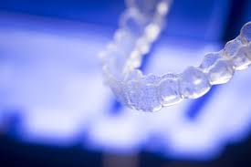 Avoid curry at all costs. How To Make Sure Clear Braces Remain Clear