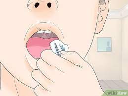 Removal of the wisdom teeth is a common dental surgery, and there is a variety of reasons for doing it. How To Sleep After Wisdom Teeth Removal 10 Steps With Pictures