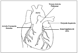 Mantente informado con las últimas noticias, videos y fotos de orejuela que te brinda univision | tudn univision. Ligadura De La Arteria Coronaria Descendente Anterior Izquierda En Ratas Tecnica Quirurgica