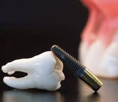 Check spelling or type a new query. Emergency Dental Care By Our Dentist In Milltown Nj