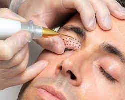 I stopped going with two sessions remaining. Dfw Laser Aesthetics Dfw Laser Aesthetics Offers The Latest In Skin Care Technology In The Dallas Fort Worth Surrounding Areas