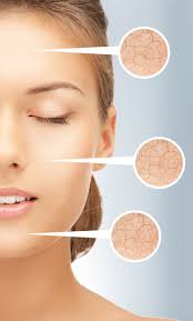 Image result for Seborrheic Dermatitis