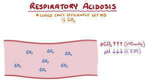 Respiratory Acidosis Endocrine And Metabolic Disorders
