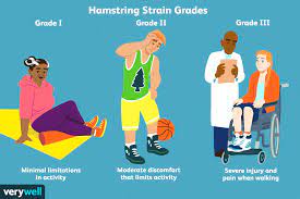 Pulled Hamstring Is A Muscle Strain Injury Of The Thigh