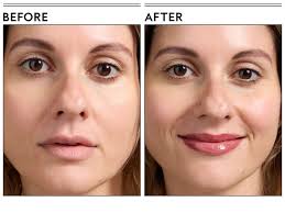 The 9 Best Lip Plumpers of 2025, Tested and Reviewed