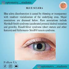 Image result for Sclera