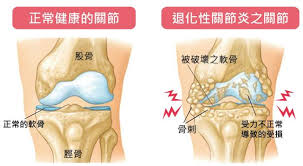 ãéåæ§éç¯çãçåçæå°çµæ