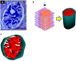 Tran1†, anthony pease1†, anna j. Three Dimensional Glomerular Reconstruction A Novel Approach To Evaluate Renal Microanatomy In Diabetic Kidney Disease Scientific Reports
