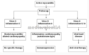 Myocarditis is a disease marked by the inflammation of the heart muscle known as the myocardium — the muscular layer of the heart wall. Myocarditis Physical Examination Symptoms Clinical Manifestations Diagnosis Medicscientist Total Health Portal