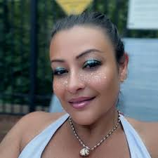 It can be caused by having children, weight loss, age, hormones, and  sometimes even genetics! Whatever the cause may be