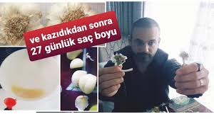 Saclari Tekrar Cikaran Sarimsak Suyunu Nasil Kullanmaliyiz Youtube