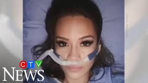 'It can happen to anyone': 31-year-old Canadian woman nearly dies of  COVID-19