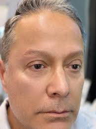 Insoo Kim, DDS, 4600 Beach Blvd, Buena Park, CA 90621, US