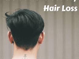 Pure aloe gel or aloe juice can be applied directly to the scalp. A Complete Guide To Stopping Hair Loss Bellatory