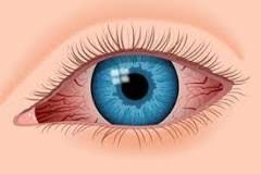 The reason is actually that of the thc inside of cannabis. How Long Do Red Eyes Last While High On Weed Quora