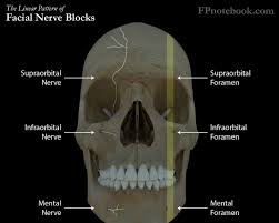 Image result for Forehead Regional Block