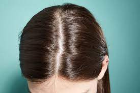 If you're experiencing male pattern hair loss, there are several ways you can stem the loss and increase hair growth. My Hair Is Thinning 5 Reasons For Hair Loss Explained