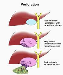 Common medical terminology abbreviations used in the medical billing and coding industry. Cbd Medical Abbreviation Gallbladder