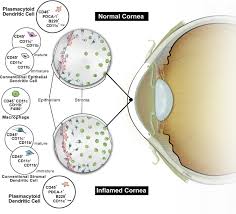 Characterization Of Resident Corneal Plasmacytoid Dendritic Cells And Their Pivotal Role In Herpes Simplex Keratitis Sciencedirect
