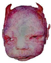 The Digital Research Library Of Illinois History Journal Chicago S Devil Baby From The Early 20th Century