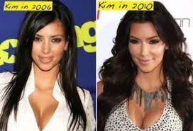Blac Chyna Before Fame Pin By Diamondroseev On Kardashian Jenner Memes Quotes Kardashian Plastic Surgery Plastic Surgery Gone Wrong Plastic Surgery