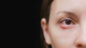 Kedutan pada ekor mata kanan bawah yang mengalami kedutan menandakan anda akan bertemu orang yang jauh. Kelopak Mata Kiri Dan Kanan Berbeda 19 Februari 2020 Tanya Dokter Klikdokter Com