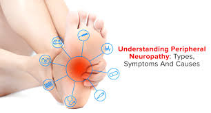Image result for Peripheral Neuropathy